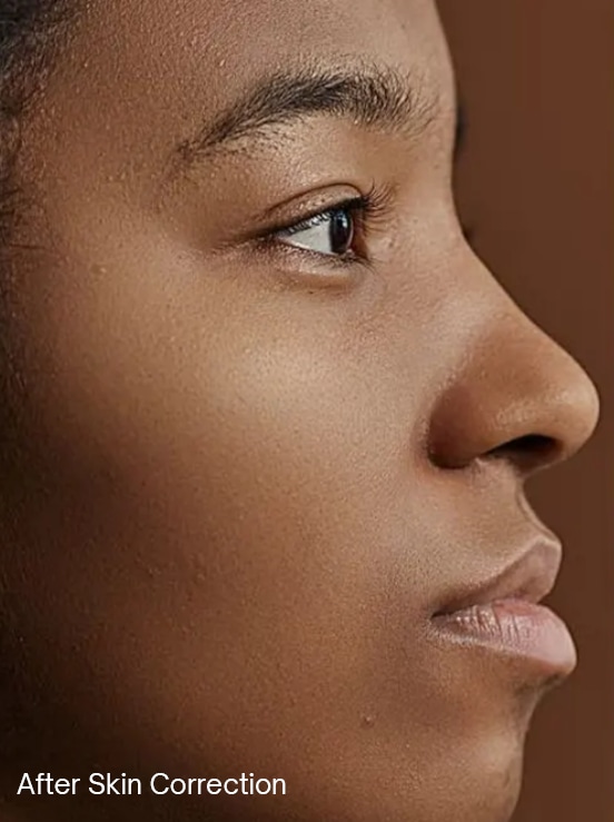 Skin correction — before